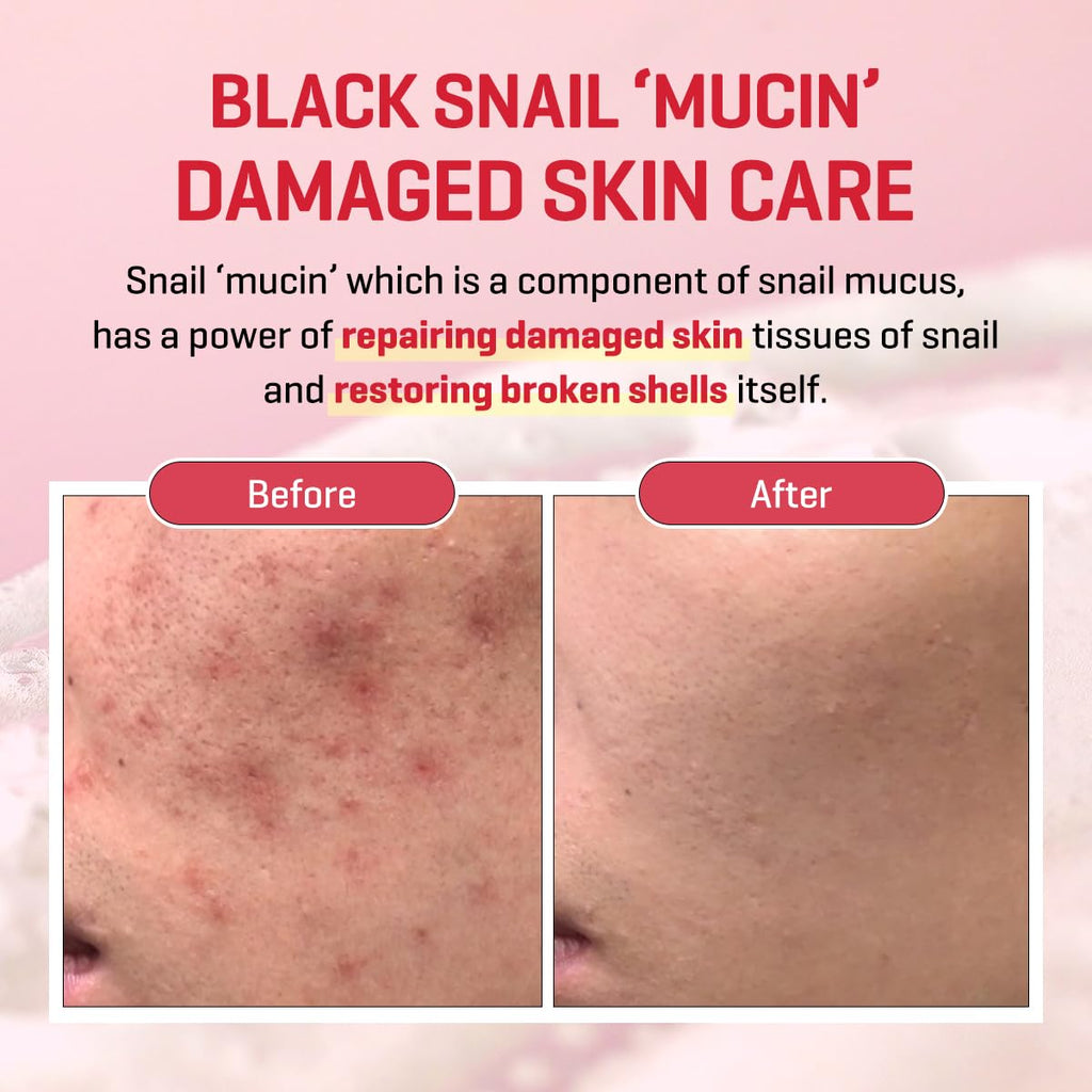 Some By Mi Snail Truecica Miracle Repair Serum-50ml