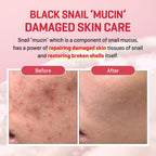 Some By Mi Snail Truecica Miracle Repair Serum-50ml