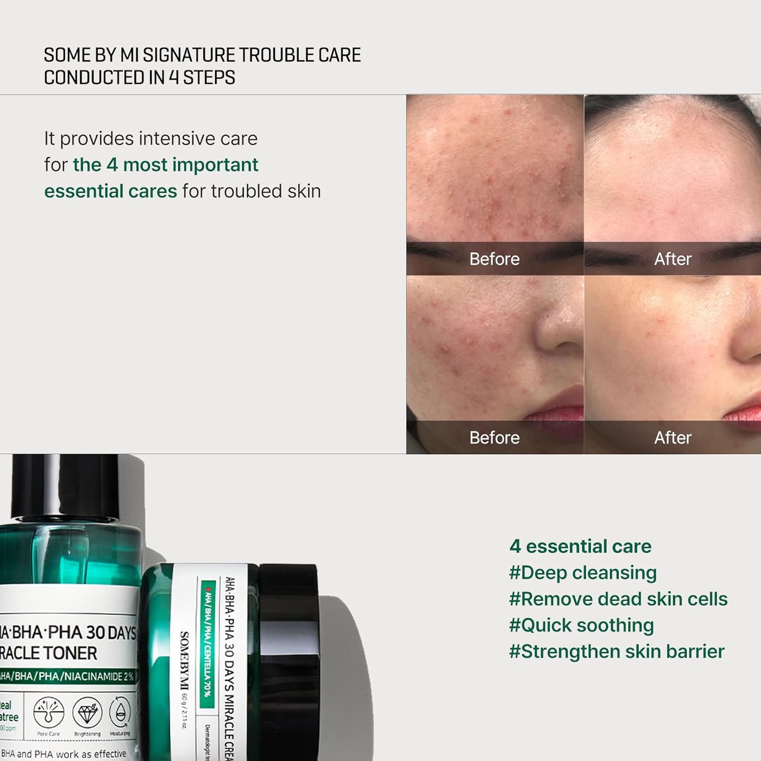 Some By Mi AHA. BHA. PHA 30 Days Miracle Mini Starter Kit Set with Bar- 4 Piece