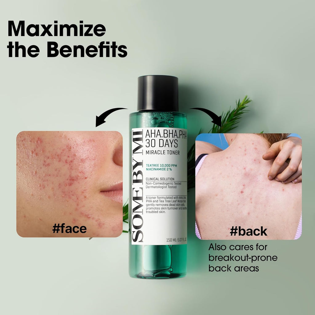 Some By Mi AHA. BHA. PHA 30 Days Miracle Toner - 150ml