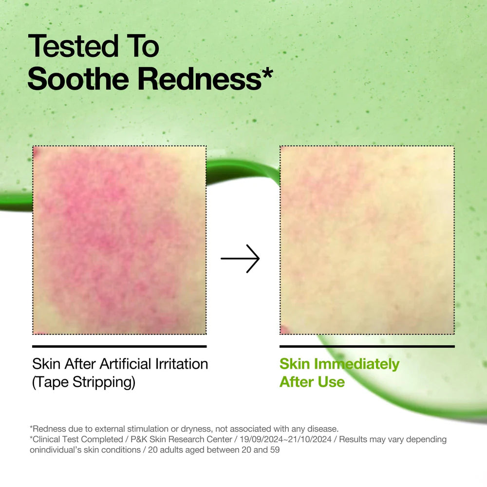 Anua Azelaic Acid 10% + Hyaluron Serum For Calm And Radiant Skin - 30Ml